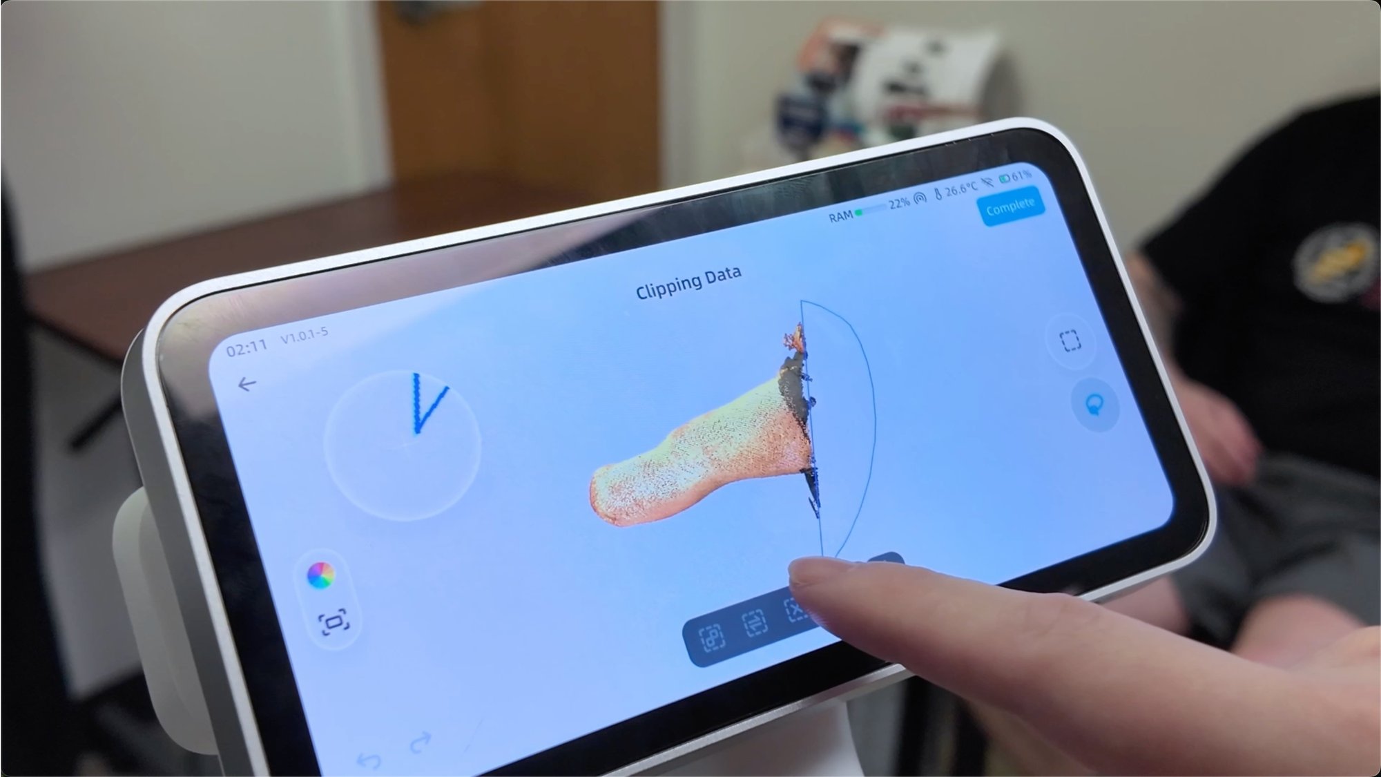 Real-time 3D leg scan on EinScan Medixa for on-device processing Real-time 3D leg scan on EinScan Medixa for on-device processing