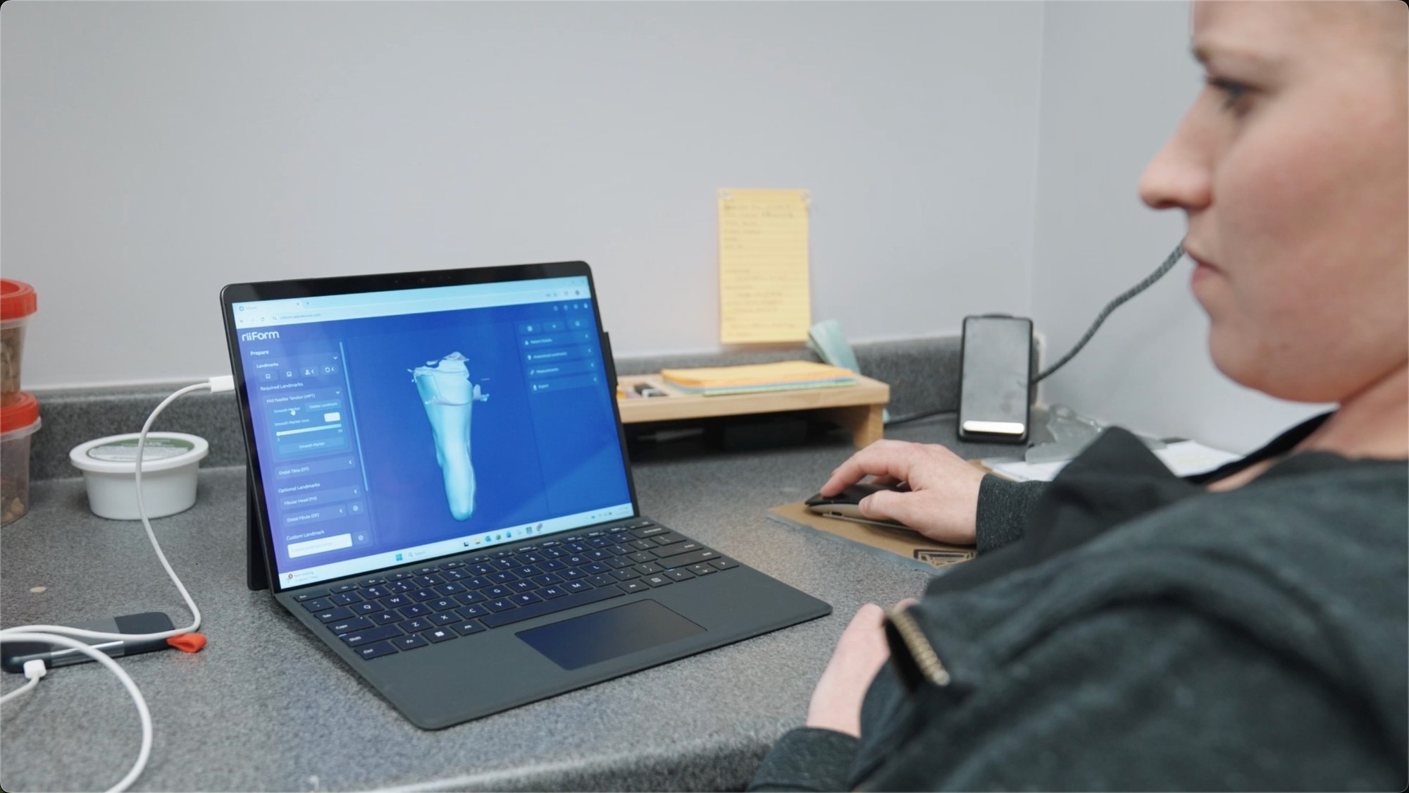 Seamless EinScan Medixa data integration with O&P design software. Seamless EinScan Medixa data integration with O&P design software.