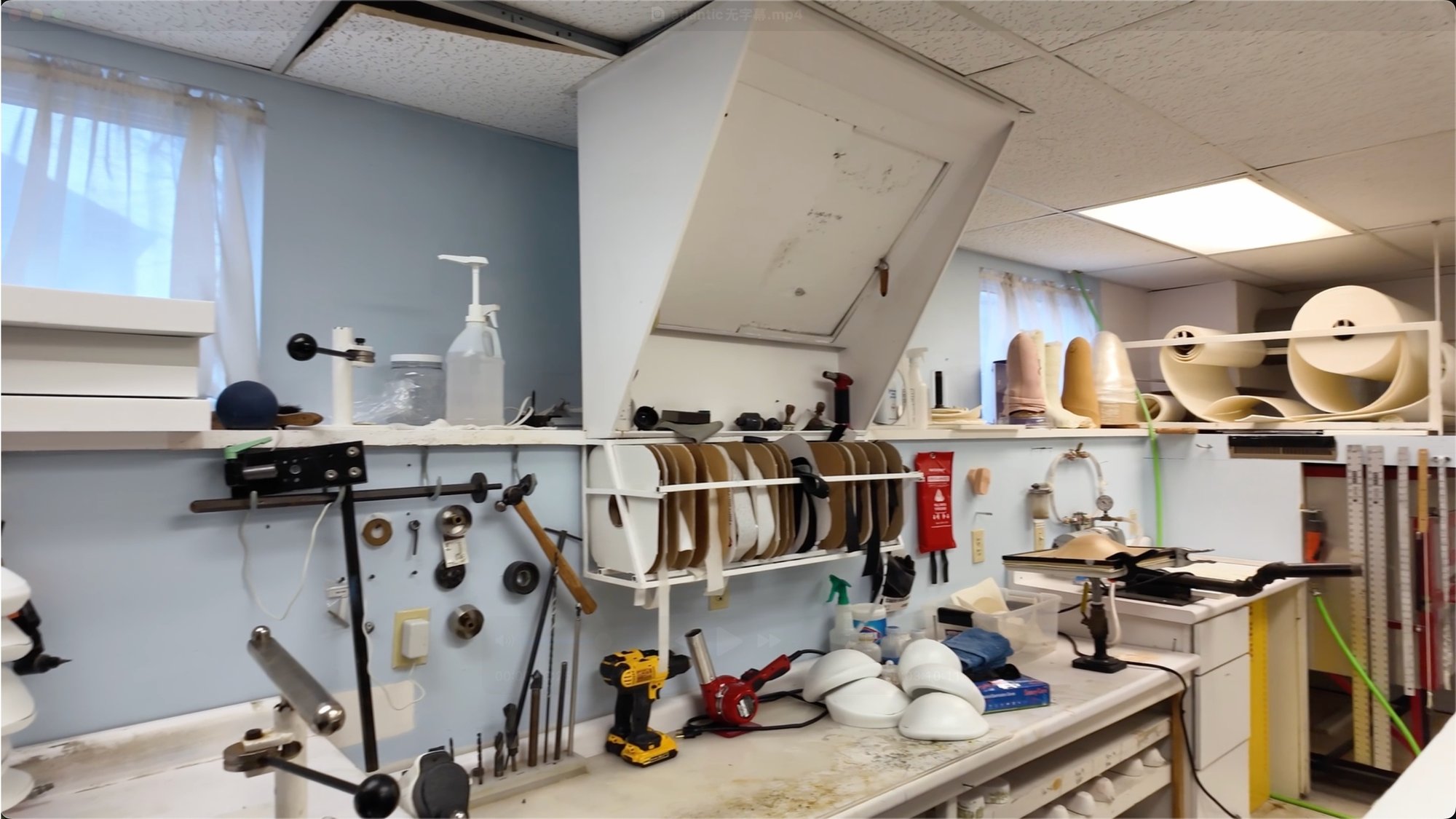 Conventional Method for Orthotics & Prosthetics Conventional Method for Orthotics & Prosthetics