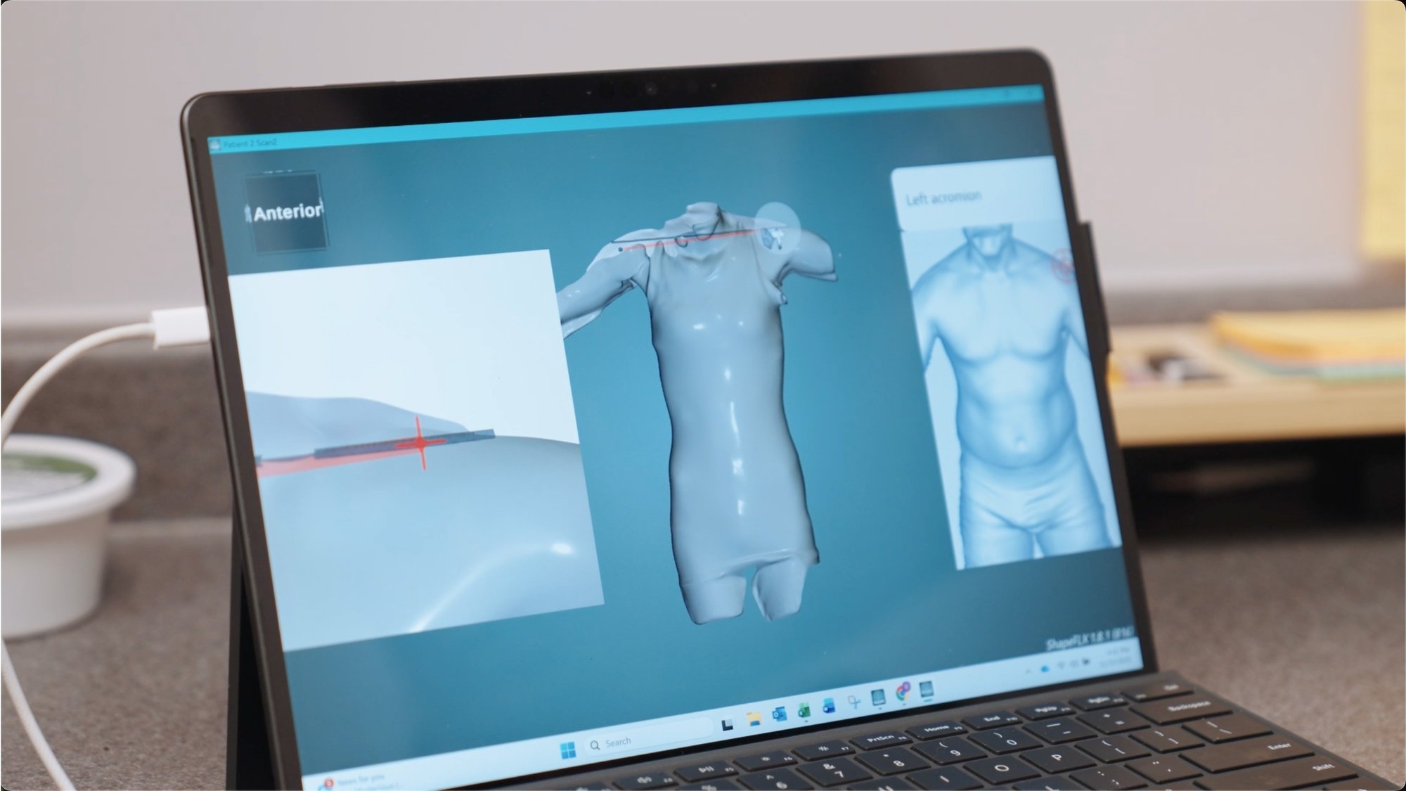 Seamless EinScan Medixa data integration with O&P design software. Seamless EinScan Medixa data integration with O&P design software.
