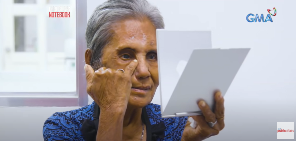 Lola Rosita’s New Face