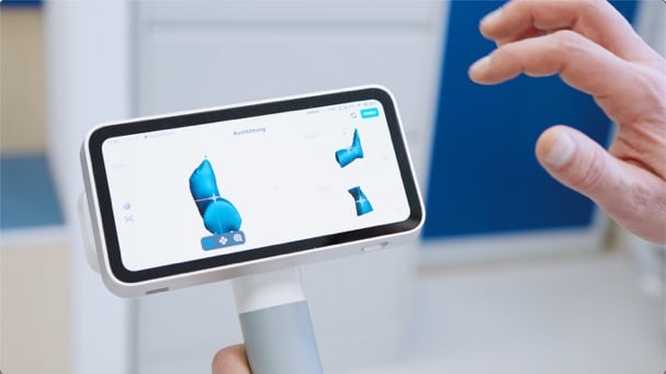 Scan data on the device Scan data on the device