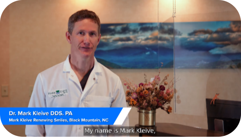 Accessori Metrologia 3D Marcatori Per Scansione 3D - 500 Pezzi Riutilizzabili Ad Alta Riflettività Scanner 3d Precisione