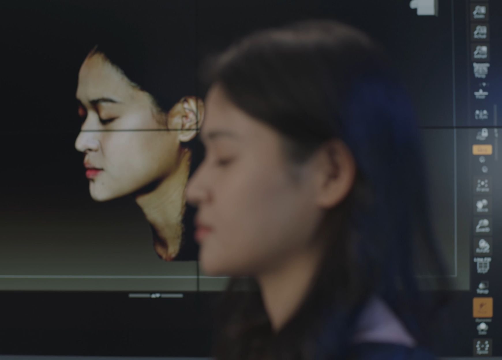 3d scanning for plastic surgery2