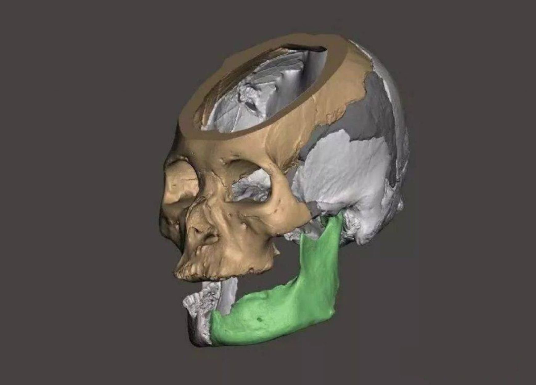 3d scanning for post-moterm reconstruction