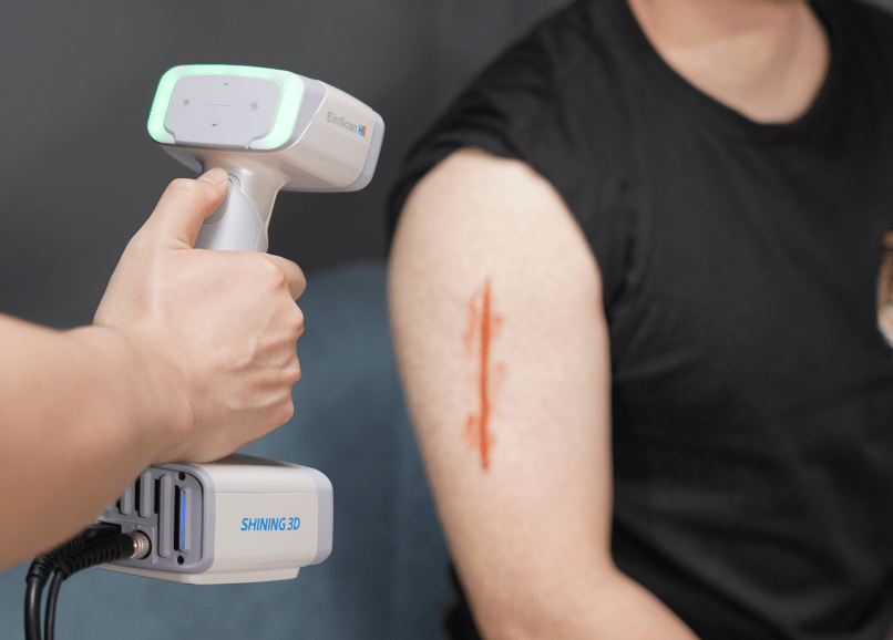 Injury Documentation and Analysis