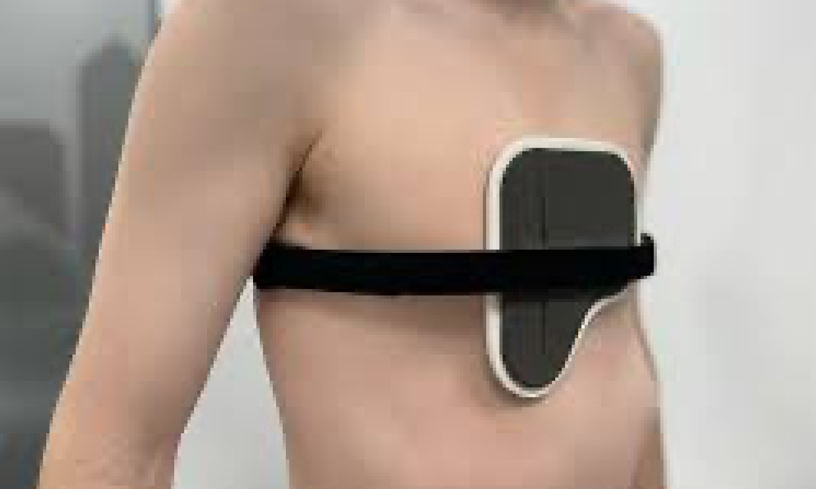 Chest Deformity Orthoses