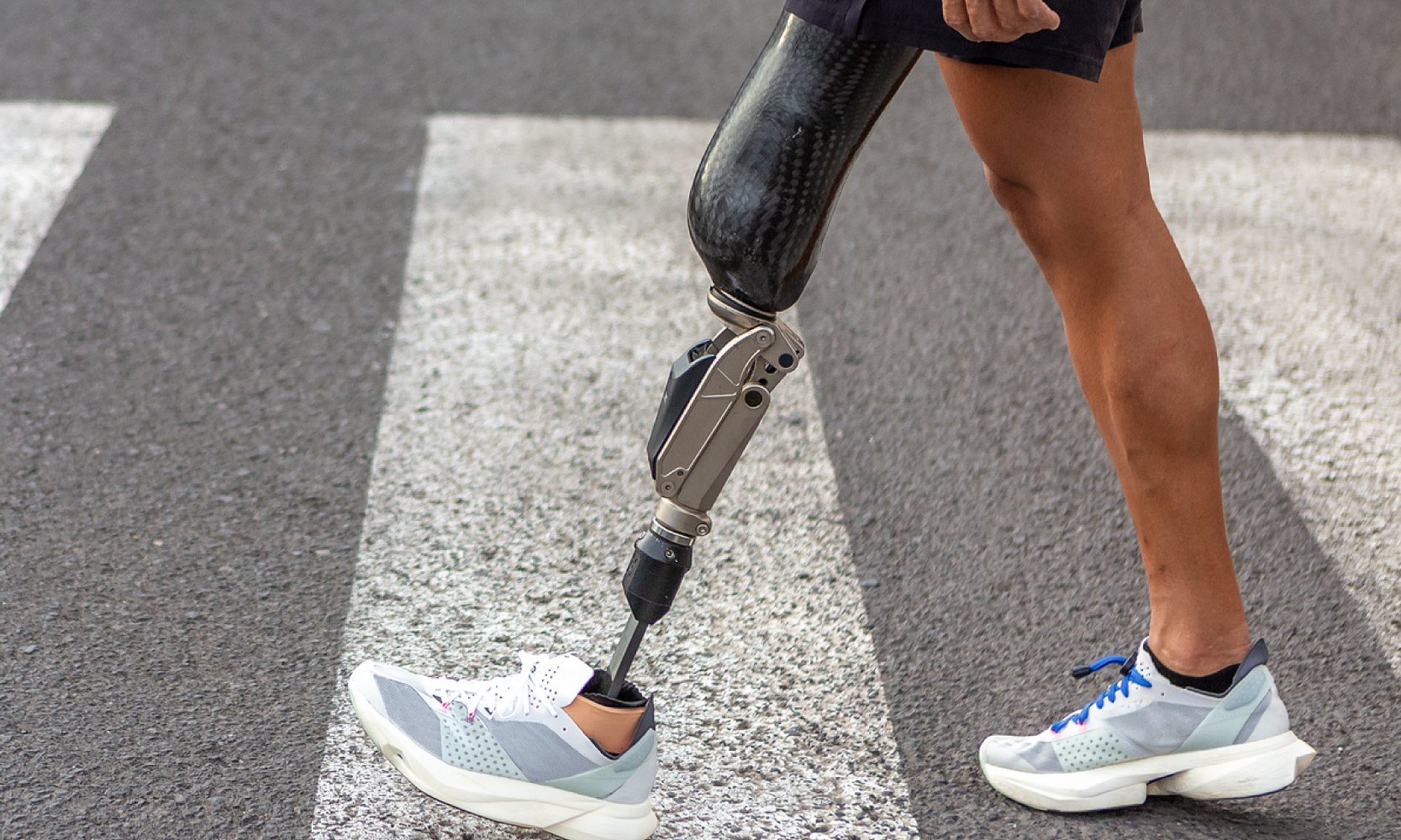 Lower Limb Prosthesis