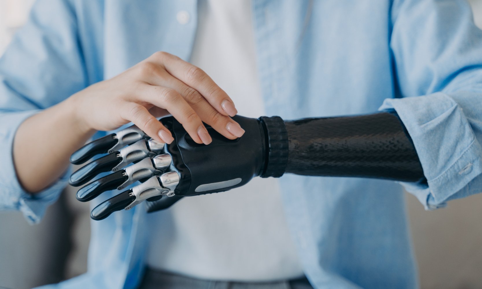 Upper Limb Prosthesis