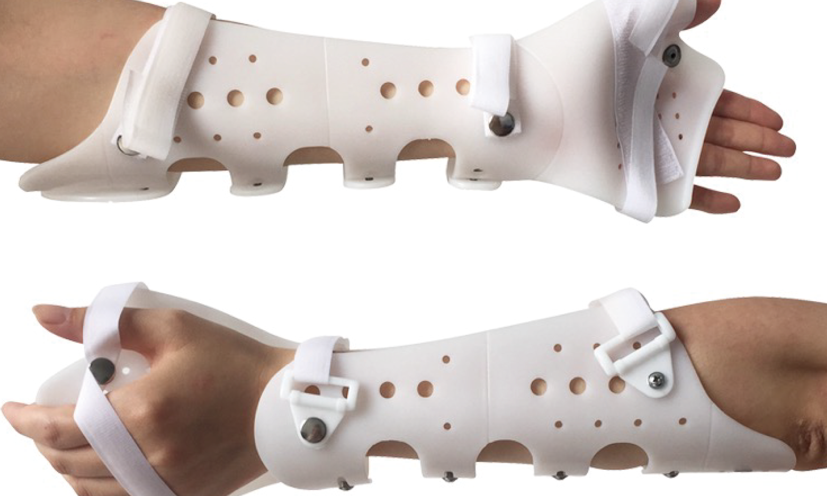 Upper limb orthoses