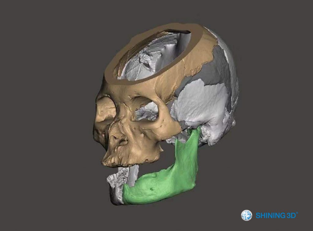 This image has an empty alt attribute; its file name is 3D-Scanning-and-3D-Printing-Reconstruct-the-Missing-Bones-5-1024x758.jpg