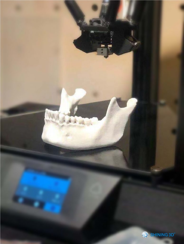 This image has an empty alt attribute; its file name is 3D-Scanning-and-3D-Printing-Reconstruct-the-Missing-Bones-6-775x1024.jpg
